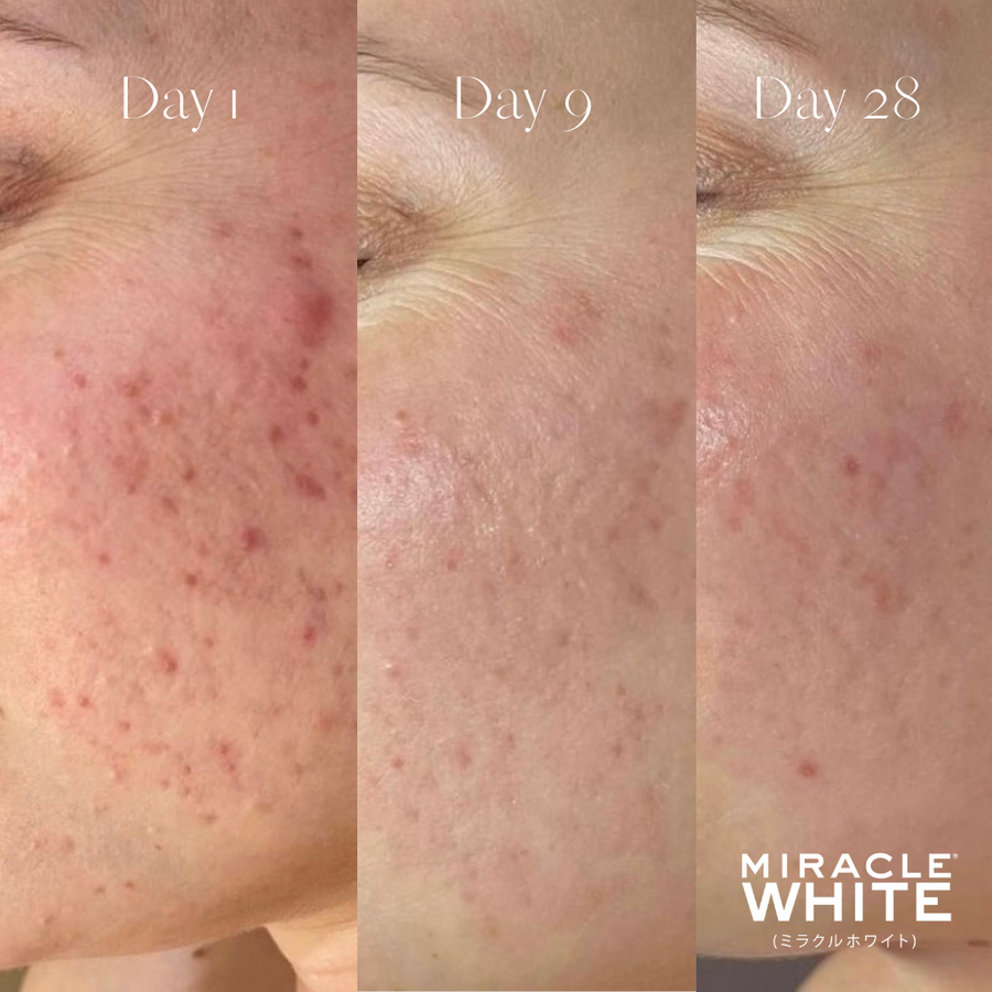 Miracle White GLOW VITAMINS Miracle White Miracle White GLOW VITAMINS Miracle White